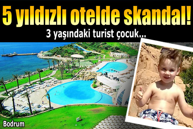 5 yıldızlı otelde inanılmaz kaza