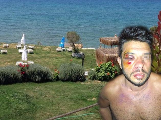 Çeşme'de 4 bin lira hesap, üstüne dayak! 