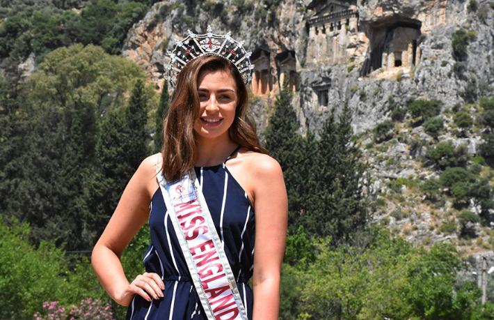 İngiltere güzeli Türkiye’nin tanıtım yüzü olacak