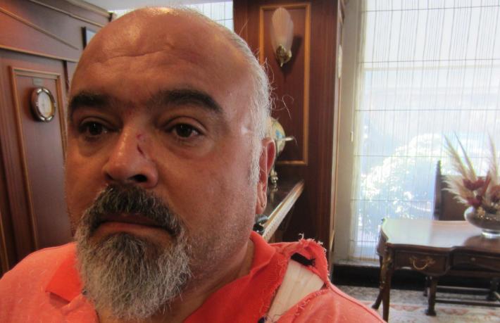 Turizmci Mehmet Gem’e çirkin saldırı