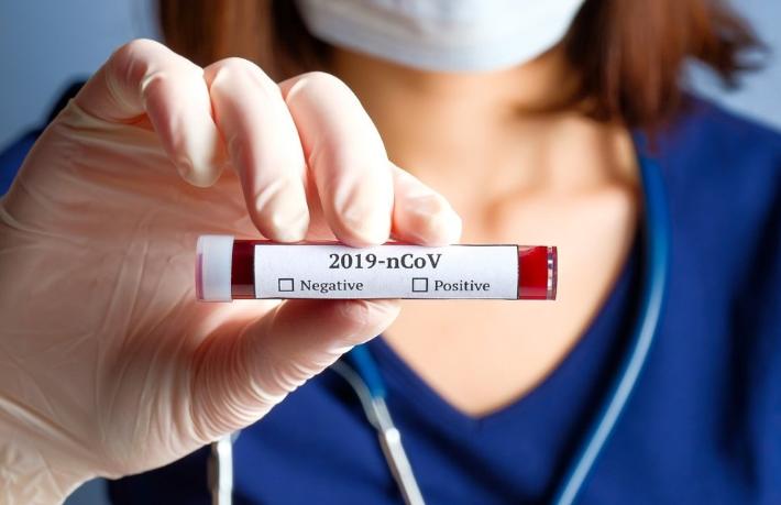 Türkiye’den dönen Rus turistte koronavirüs çıktı