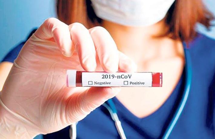 Tatilci akınına uğrayan Bodrum’da rastgele korona taraması başladı