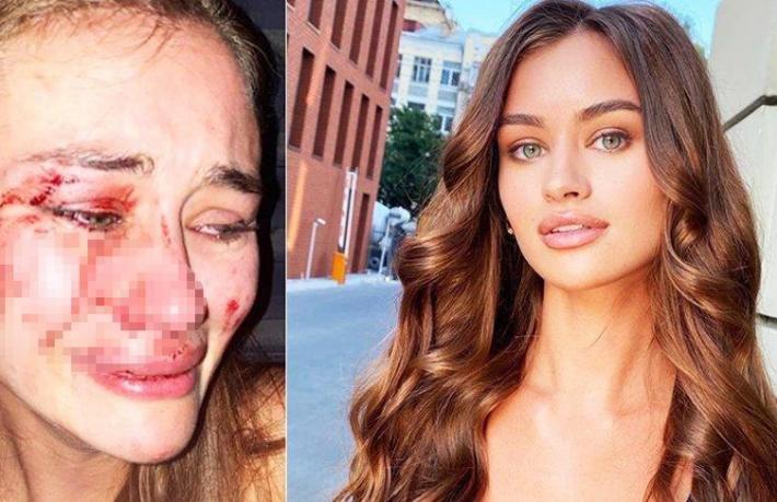 Ukraynalı model plaj çalışanlarının özrünü kabul etti