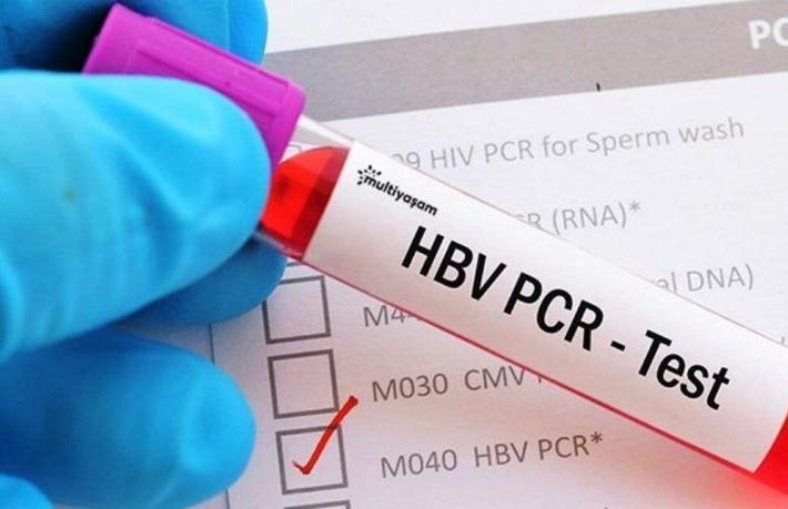 THY, PCR kararını erteledi