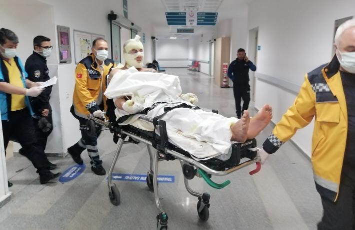 Otelde intihar girişimi... Hem kendini hem de oteli yaktı