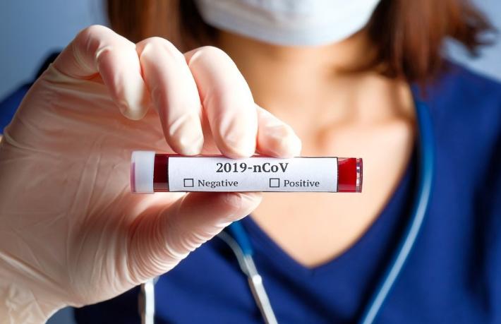 Antalya'da tartışma yaratan karar... Herkese test mi yapılacak?