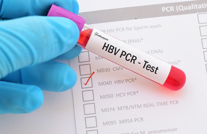 Türkiye ile Sırbistan arasında PCR testi zorunluluğu kaldırıldı