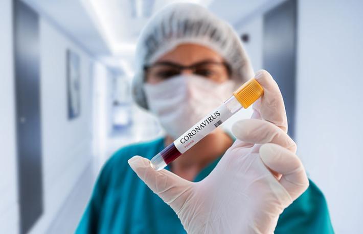 PCR testleri yeni genelge ile nerelerde zorunlu olacak?