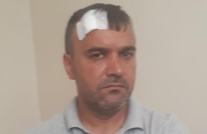 'Alanya’da otel çalışanları misafiri darp etti' iddiası
