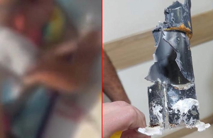 5 yıldızlı otelde 4 yaşındaki çocuğun elini havuzun vakumu kaptı