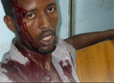 Somali'de otele saldırı, 31 ölü...