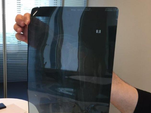 Röntgen filmi ve böcekle tur şikayeti